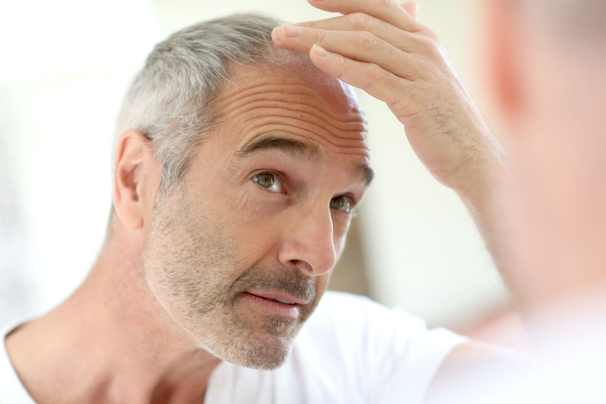 Calvizie: nell'immagine un uomo si controlla i capelli